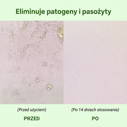 Brak apetytu rano, mgła umysłowa, wzdęty brzuch? Te objawy, które pasożyty zostawiają po 40. roku życia